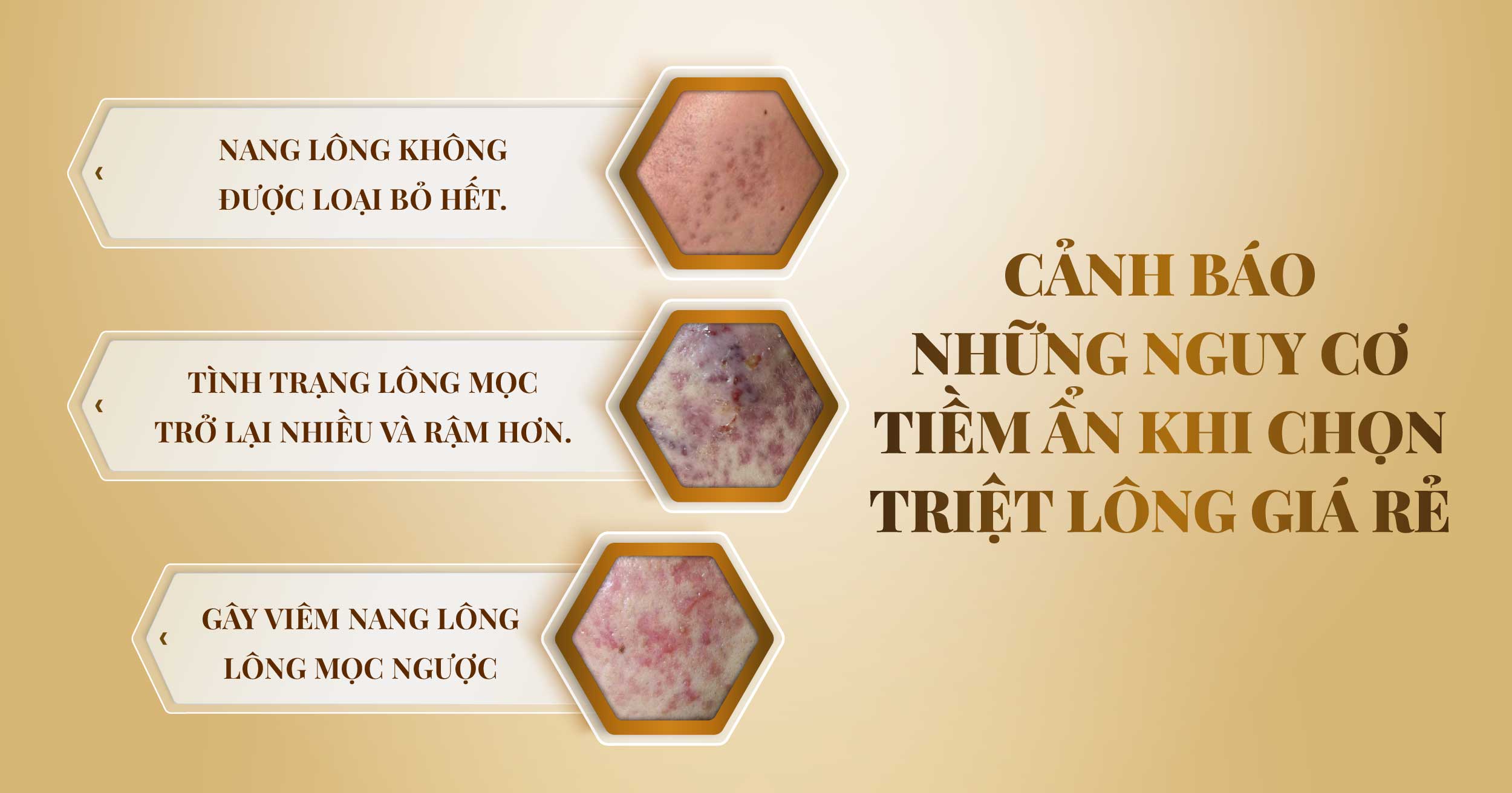 Chi phí triệt lông giá bao nhiêu tiền? Bảng giá triệt lông 2024 13 Bang gia triet long 2023 03