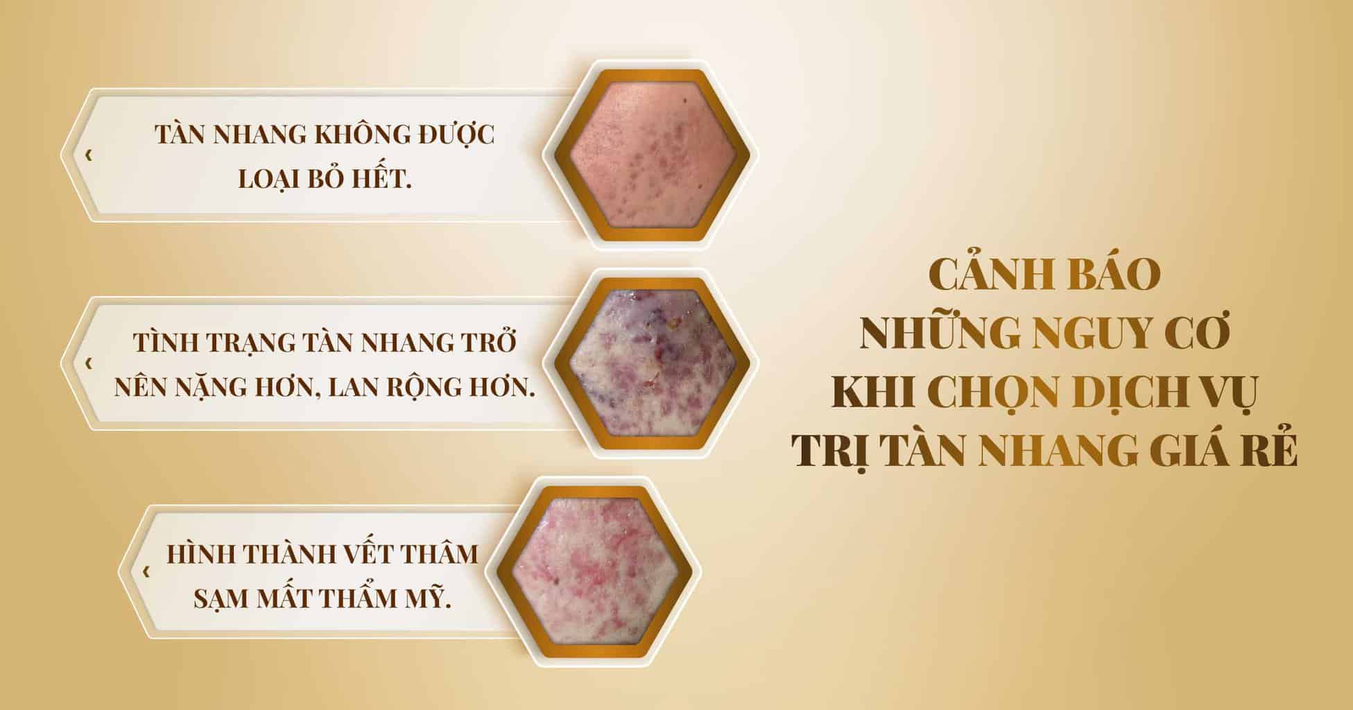 Chi phí trị tàn nhang - Bảng giá trị tàn nhang 2024 10 Cảnh báo những nguy cơ có thể gặp khi trị tàn nhang giá rẻ.