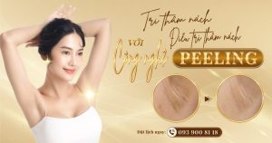 Điều trị nách thâm bằng công nghệ Peeling