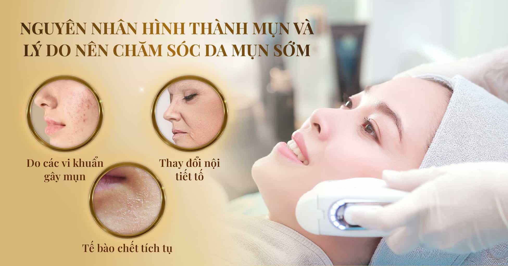 Chăm sóc da mụn hiệu quả và an toàn bằng công nghệ cao 11 nguyen nhan hinh thanh mun va ly do nen cham soc da mun som