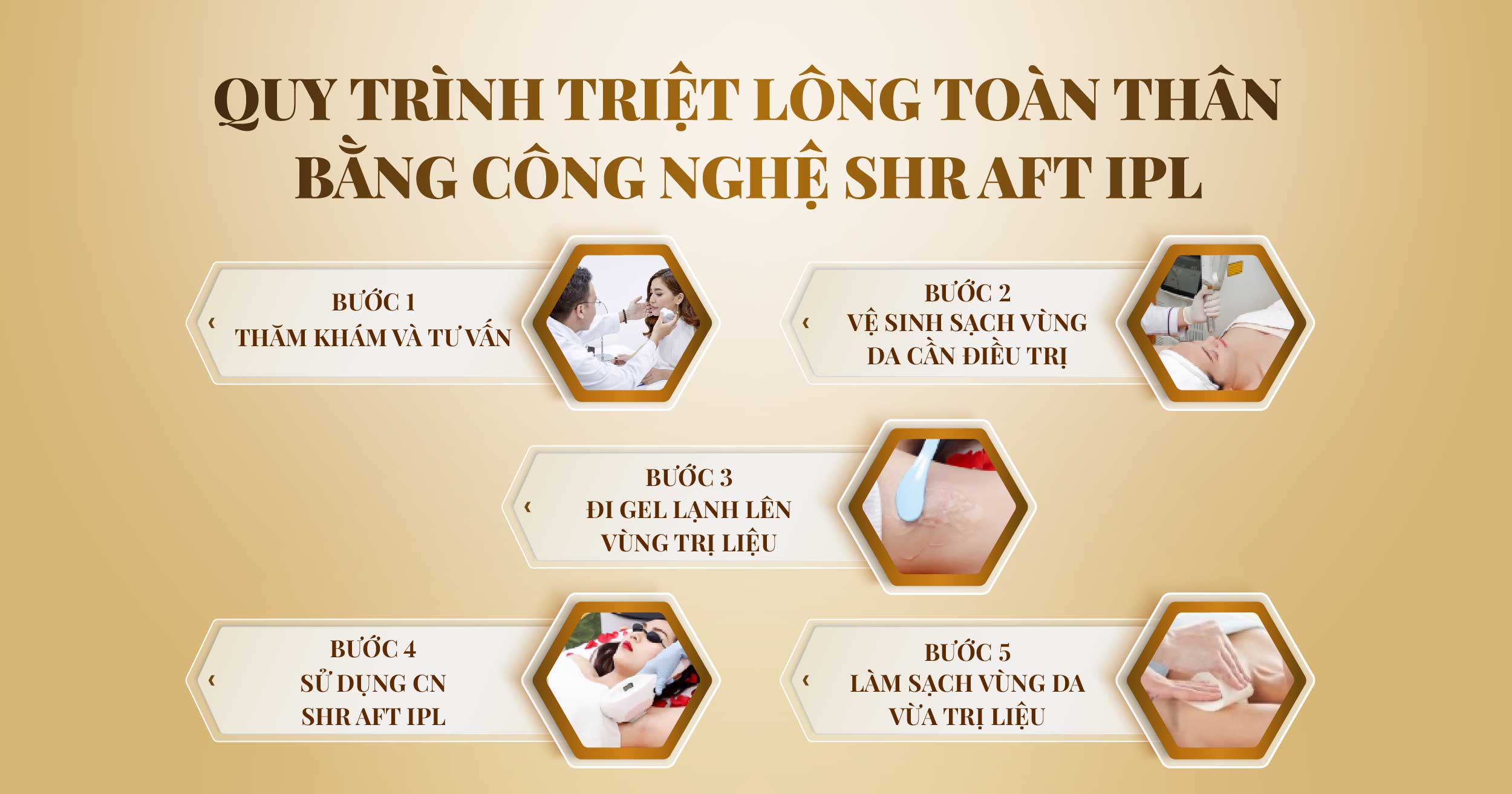 Triệt lông toàn thân bằng công nghệ SHR AFT IPL 19 Triet long toan than 02